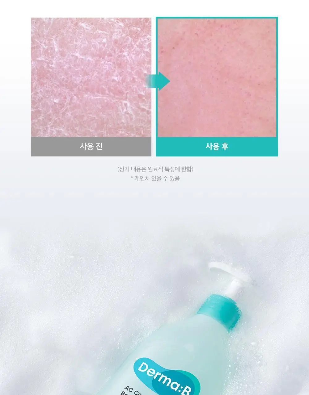 [등드름/여드름기능성] 더마비AC컨트롤바디워시 420ml 상세페이지 17